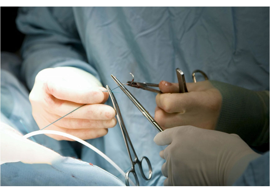 Surgical Gut Suture